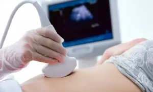 Badania prenatalne w 12 tygodniu ciąży: lekarz wykonuje USG, widok na monitorze pokazuje obraz płodu.