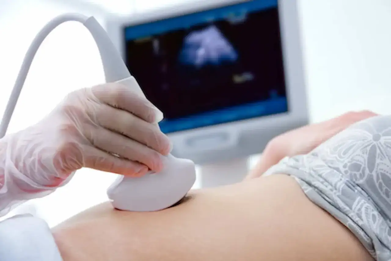 Badania prenatalne w 12 tygodniu ciąży: lekarz wykonuje USG, widok na monitorze pokazuje obraz płodu.
